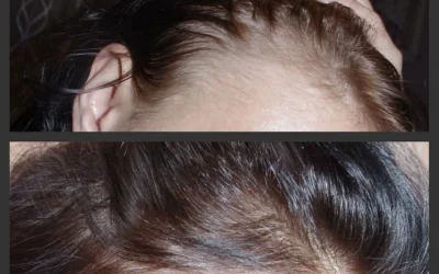 Combate a queda de cabelo e transforma os fios em 15 dias_ SAIBA MAIS