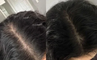 I'm struggling with thinning hair_ I asked an expert what the best treatments are, plus 13 hair product recommendations